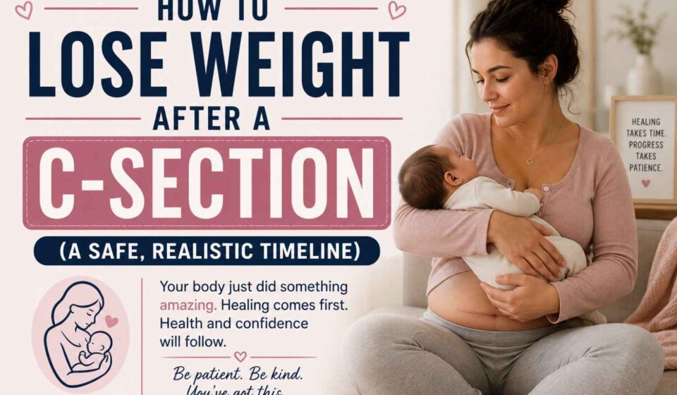 How to Lose Weight After a C-Section